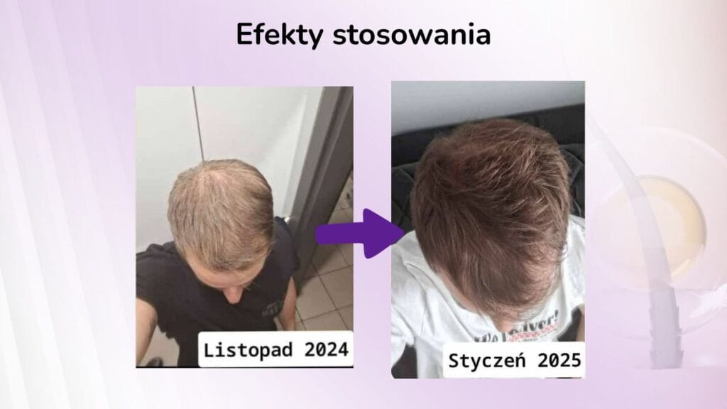 suplement na włosy Keratyna DuoLife